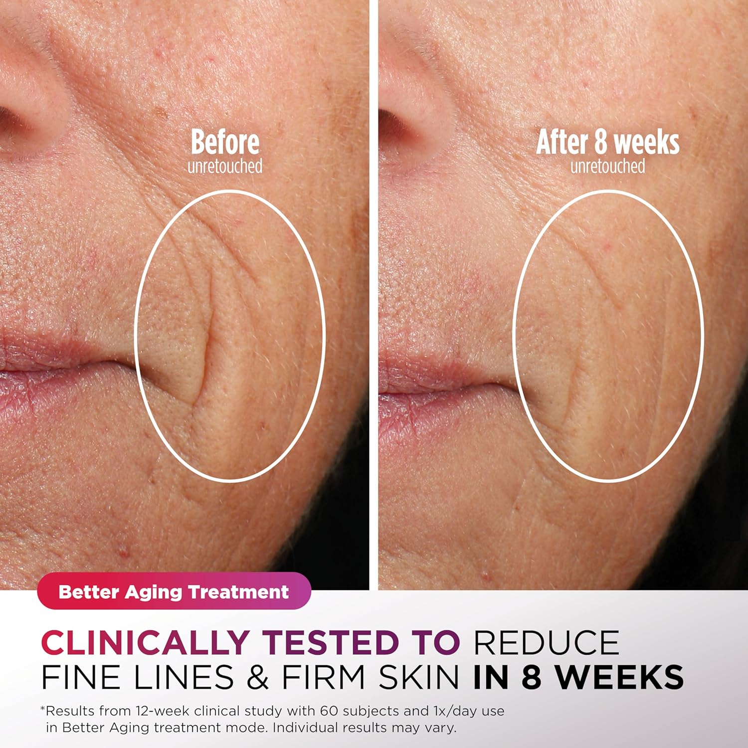 Cryoglow LED Face Mask – Anti-Aging & Blemish Repair